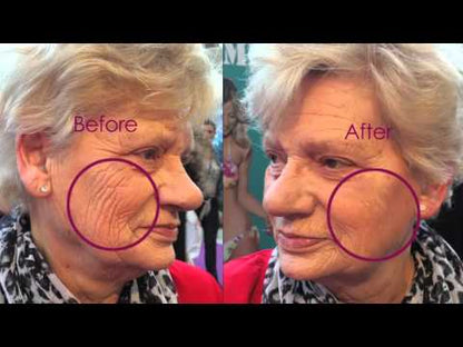 FaceLift Serum Rimpels kraaienpoten en wallen